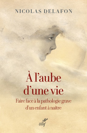 A L AUBE D'UNE VIE - FAIRE FACE A LA PATHOLOGIE GRAVE D UN ENFANT A NAITRE
