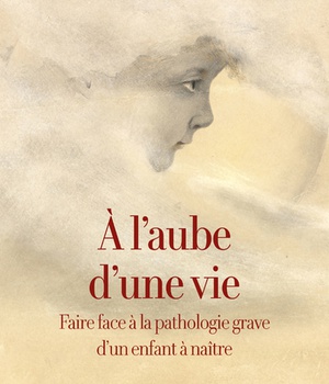A L AUBE D'UNE VIE - FAIRE FACE A LA PATHOLOGIE GRAVE D UN ENFANT A NAITRE